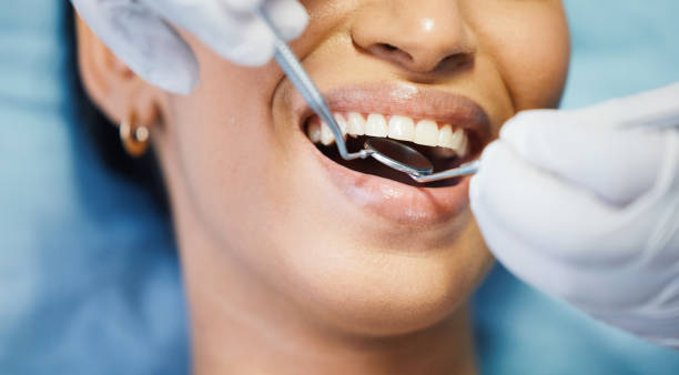 Best Emergency Denture Repair in Shiremanstown, PA